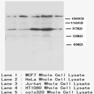 anti-Chemokine (C-X-C Motif) Receptor 4 (CXCR4) (N-Term) antibody avatar