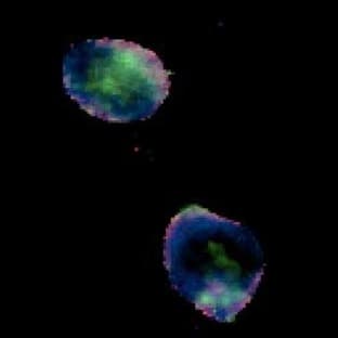 anti-Chemokine (C-X-C Motif) Receptor 4 (CXCR4) (N-Term), (Extracellular Domain) antibody avatar