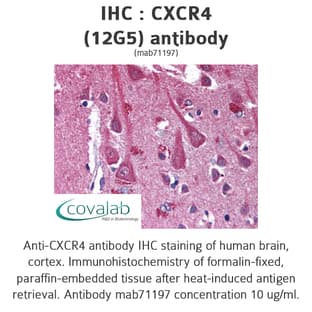 anti-Chemokine (C-X-C Motif) Receptor 4 (CXCR4) antibody avatar