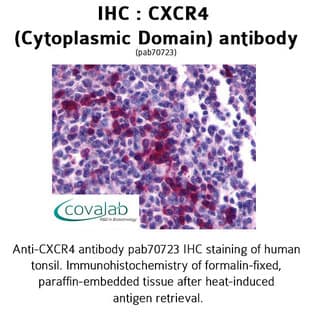 anti-Chemokine (C-X-C Motif) Receptor 4 (CXCR4) (3rd Cytoplasmic Domain) antibody avatar