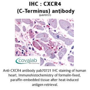 anti-Chemokine (C-X-C Motif) Receptor 4 (CXCR4) (C-Term) antibody avatar