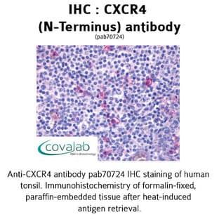 anti-Chemokine (C-X-C Motif) Receptor 4 (CXCR4) (N-Term), (Extracellular Domain) antibody avatar