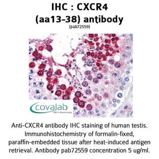 anti-Chemokine (C-X-C Motif) Receptor 4 (CXCR4) (N-Term), (Extracellular Domain), (AA 13-38) antibody avatar
