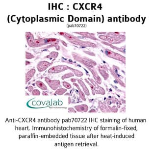 anti-Chemokine (C-X-C Motif) Receptor 4 (CXCR4) (Cytoplasmic Domain) antibody avatar