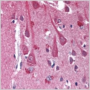 anti-Chemokine (C-X-C Motif) Receptor 4 (CXCR4) antibody avatar