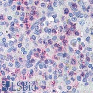 anti-Chemokine (C-X-C Motif) Receptor 4 (CXCR4) (AA 182-196) antibody avatar