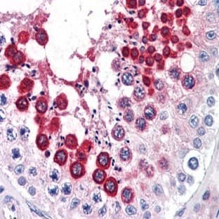anti-Chemokine (C-X-C Motif) Receptor 4 (CXCR4) (N-Term), (Extracellular Domain), (AA 13-38) antibody avatar
