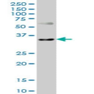 anti-Chemokine (C-X-C Motif) Receptor 4 (CXCR4) (AA 1-47) antibody avatar