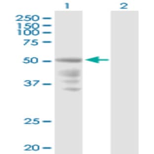 anti-Chemokine (C-X-C Motif) Receptor 4 (CXCR4) (AA 1-352) antibody avatar