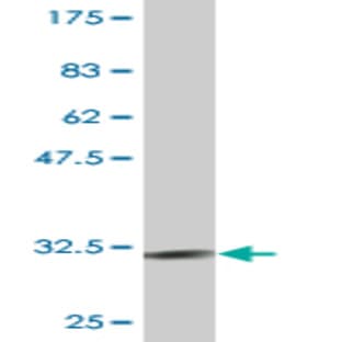 anti-Chemokine (C-X-C Motif) Receptor 4 (CXCR4) (AA 1-46) antibody avatar