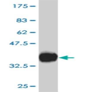anti-Chemokine (C-X-C Motif) Receptor 4 (CXCR4) (AA 1-46) antibody avatar