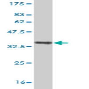 anti-Chemokine (C-X-C Motif) Receptor 4 (CXCR4) (AA 1-46) antibody avatar