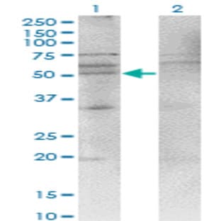 anti-Chemokine (C-X-C Motif) Receptor 4 (CXCR4) (AA 1-46) antibody avatar