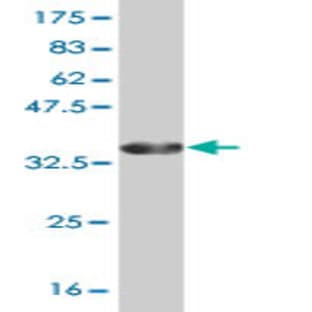 anti-Chemokine (C-X-C Motif) Receptor 4 (CXCR4) (AA 1-46) antibody avatar