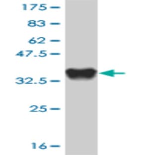 anti-Chemokine (C-X-C Motif) Receptor 4 (CXCR4) (AA 1-46) antibody avatar