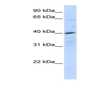 anti-Chemokine (C-X-C Motif) Receptor 4 (CXCR4) antibody avatar