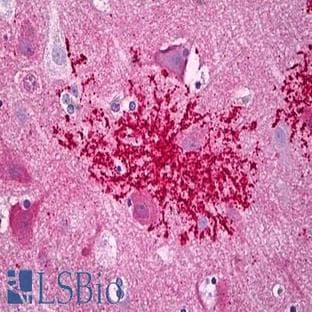 anti-Chemokine (C-X-C Motif) Receptor 4 (CXCR4) (AA 300-349) antibody avatar