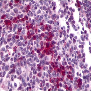anti-Chemokine (C-X-C Motif) Receptor 4 (CXCR4) (Cytoplasmic Domain) antibody avatar