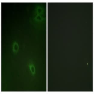 anti-Chemokine (C-X-C Motif) Receptor 4 (CXCR4) (pSer339) antibody avatar