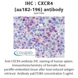 anti-Chemokine (C-X-C Motif) Receptor 4 (CXCR4) (AA 182-196) antibody avatar
