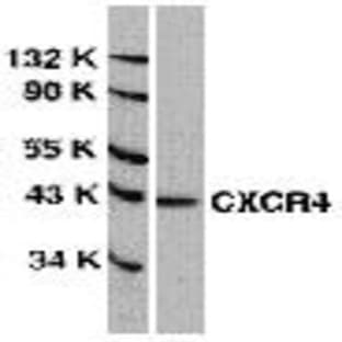 anti-Chemokine (C-X-C Motif) Receptor 4 (CXCR4) antibody avatar