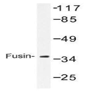 anti-Chemokine (C-X-C Motif) Receptor 4 (CXCR4) antibody avatar