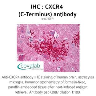 anti-Chemokine (C-X-C Motif) Receptor 4 (CXCR4) (C-Term) antibody avatar