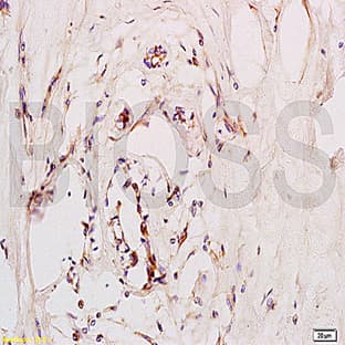 anti-Chemokine (C-X-C Motif) Receptor 4 (CXCR4) antibody avatar
