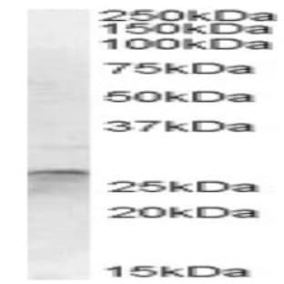 anti-OTU Domain, Ubiquitin Aldehyde Binding 2 (OTUB2) (Internal Region) antibody