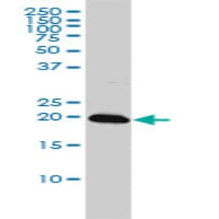 anti-Centromere Protein M (CENPM) (AA 1-181) antibody avatar