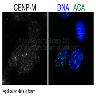 anti-Centromere Protein M (CENPM) (Middle Region) antibody avatar