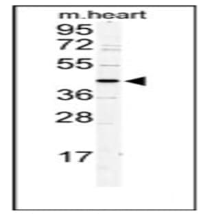 anti-Defective in Sister Chromatid Cohesion 1 Homolog (S. Cerevisiae) (DSCC1) (N-Term) antibody avatar