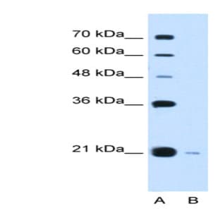 anti-DCTP Pyrophosphatase 1 (DCTPP1) (Middle Region) antibody avatar