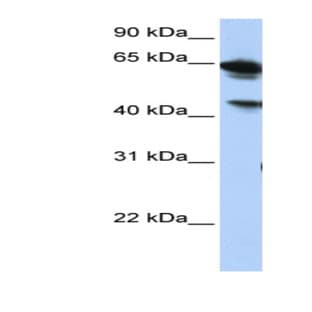 anti-Abhydrolase Domain Containing 16A (ABHD16A) (Middle Region) antibody avatar