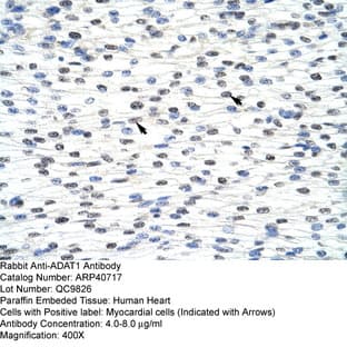 anti-Adenosine Deaminase, tRNA-Specific 1 (ADAT1) (C-Term) antibody avatar