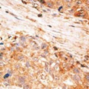 anti-Baculoviral IAP Repeat-Containing 7 (BIRC7) (C-Term) antibody avatar