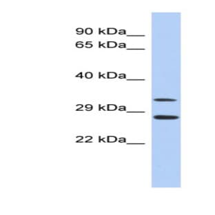 anti-Baculoviral IAP Repeat-Containing 7 (BIRC7) (Middle Region) antibody avatar