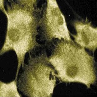 anti-Cholinergic Receptor, Nicotinic, alpha 1 (Muscle) (CHRNA1) (AA 332-457) antibody avatar