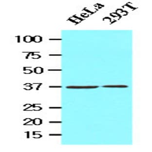anti-Epilepsy, Progressive Myoclonus Type 2A, Lafora Disease (Laforin) (EPM2A) (AA 243-331) antibody avatar