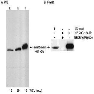 anti-Cell Division Cycle 73, Paf1/RNA Polymerase II Complex Component, Homolog (S. Cerevisiae) (CDC73) antibody avatar