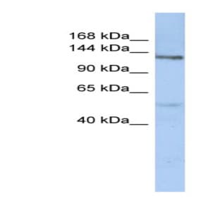anti-Chondroitin Sulfate Synthase 3 (CHSY3) (N-Term) antibody avatar