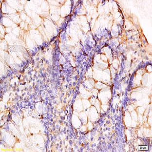 anti-Adiponectin Receptor 2 (ADIPOR2) antibody avatar