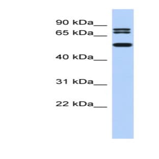 anti-Ceramide Synthase 4 (CERS4) (N-Term) antibody avatar