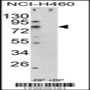 anti-Acyl-CoA Synthetase Short-Chain Family Member 3 (ACSS3) (AA 224-251), (Center) antibody avatar