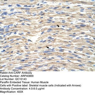 anti-CDKN2A Interacting Protein (CDKN2AIP) (C-Term) antibody avatar