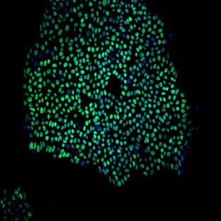 anti-Nanog Homeobox (NANOG) antibody