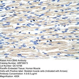 anti-Chromobox Homolog 6 (CBX6) (N-Term) antibody avatar