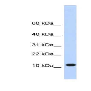 anti-Chromosome 10 Open Reading Frame 57 (C10ORF57) (Middle Region) antibody avatar
