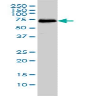 anti-CDK5 Regulatory Subunit Associated Protein 3 (CDK5RAP3) (AA 1-507) antibody avatar