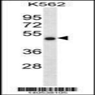 anti-Coiled-Coil Domain Containing 6 (CCDC6) (N-Term), (AA 54-82) antibody avatar